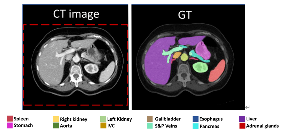 深度学习算法的5种标志性用途 _ 图像识别技术前瞻 深度学习算法的5种标志性用途 _ 图像识别技术前瞻