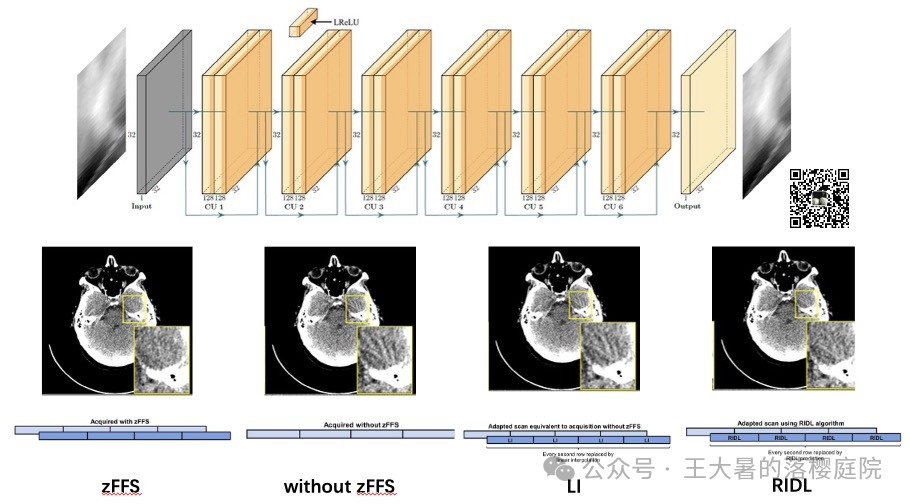 #108 CT重建的3D深度学习技术——深度学习图像重建算法分类2 #108 CT重建的3D深度学习技术——深度学习图像重建算法分类2