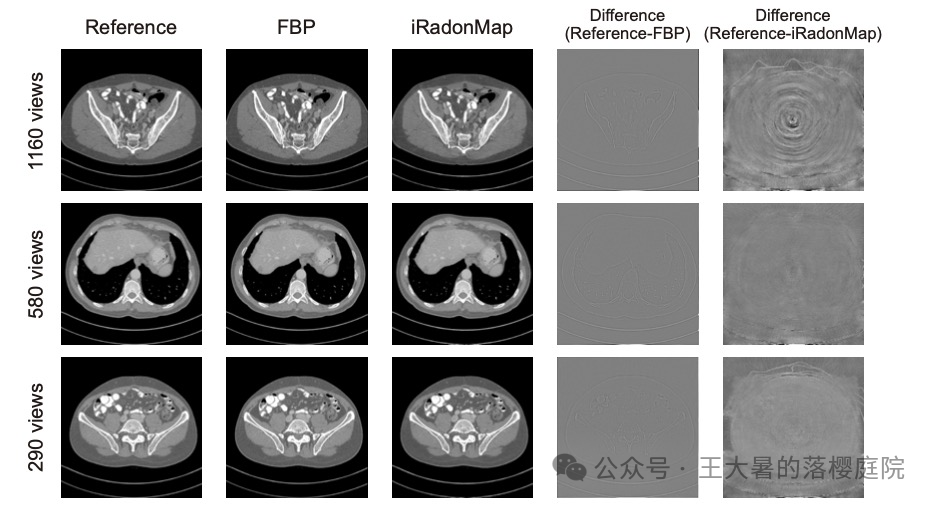 #108 CT重建的3D深度学习技术——深度学习图像重建算法分类2 #108 CT重建的3D深度学习技术——深度学习图像重建算法分类2
