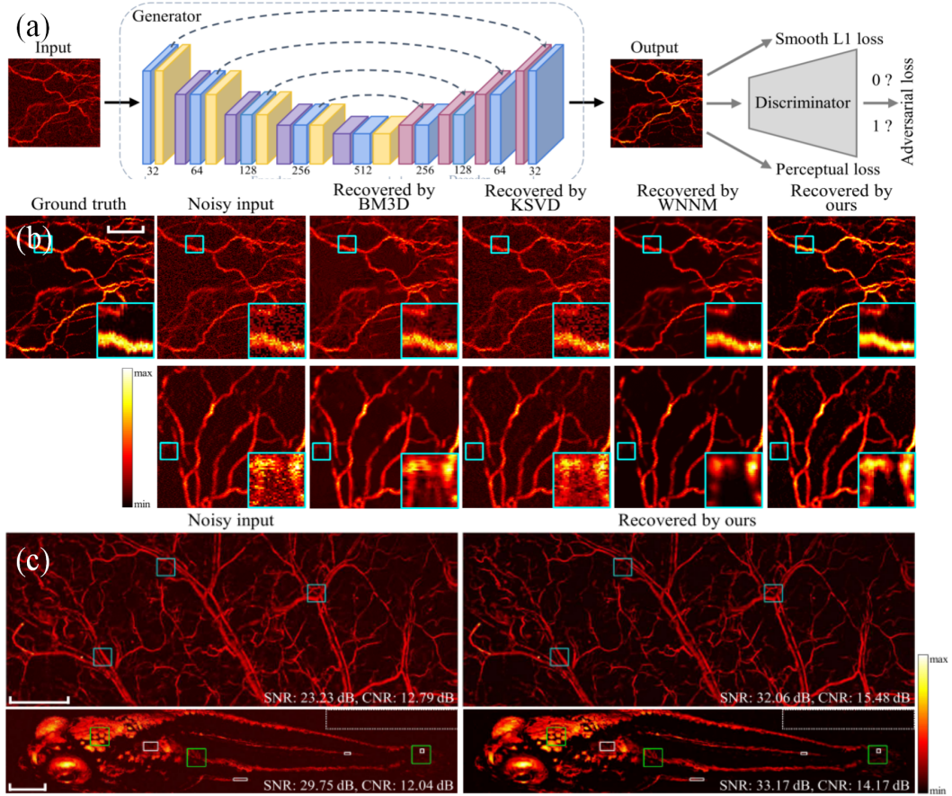 综述:深度学习驱动下的光声成像技术 综述:深度学习驱动下的光声成像技术